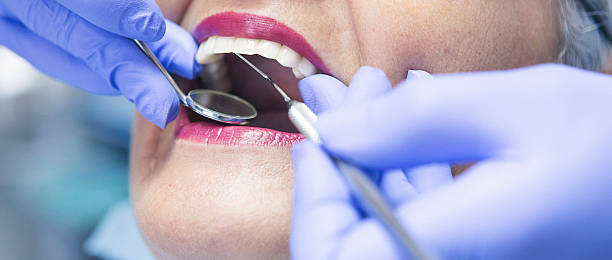 Best Emergency Treatment for Dental Infections or Abscesses in West View, PA